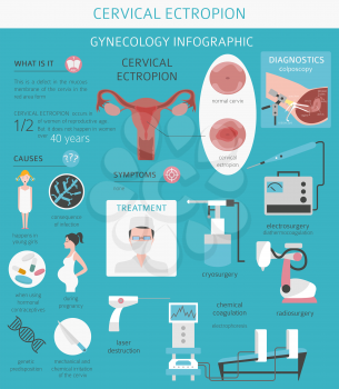 Cervical ectropion. Ginecological medical desease infographic. Vector illustration