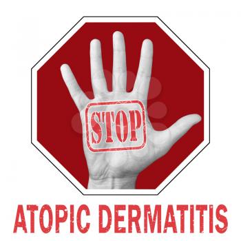 Stop atopic dermatitis conceptual illustration. Open hand with the text stop atopic dermatitis. Dermatological Diseases