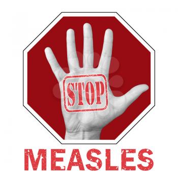 Stop measles conceptual illustration. Open hand with the text stop measles. Global social problem