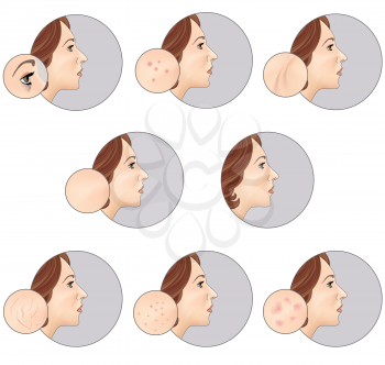 Skincare label vector set. Woman's skin before and after the procedure on a gray background. Human Skin Problem Illustration
