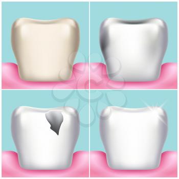 Dental problems, caries, plaque and gum disease, healthy tooth vector illustration. Stomatology and treat unhealthy teeth illustration