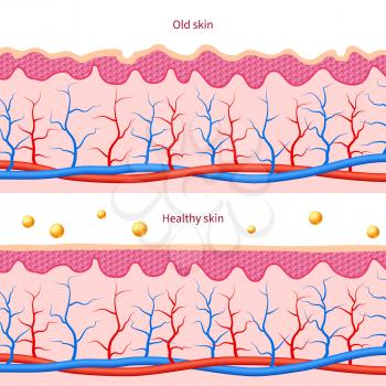 Collagen human skin effect. Close up damaged old and healthy vector medical skin care cosmetic diagrams. Layer of himan skin illustration