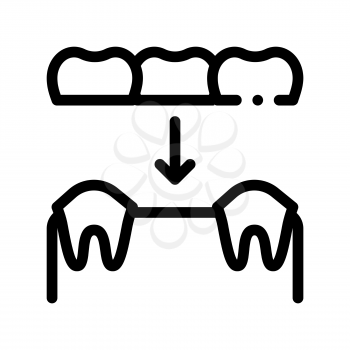 Dental Prosthesis Stomatology Vector Sign Icon Thin Line. Stomatology Dentist Instrument Equipment And Device Linear Pictogram. Medical Treatment Therapy Dentistry Monochrome Contour Illustration