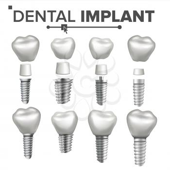 Dental Implant Set Vector. Implant Structure. Crown, Abutment, Screw. Care Stomatology Realistic Isolated Illustration