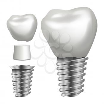 Dental Implant Vector. Medical Poster, Banner Design Element. Stomatology Dentist Advertisement. Realistic Isolated Illustration