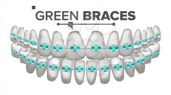 Green Child Braces Vector. Tooth And Dental Braces. Human Jaw. 3D Isolated Illustration
