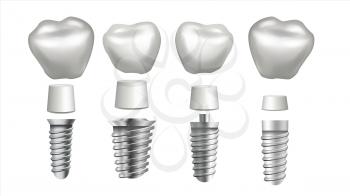 Dental Implant Set Vector. Dental Clinic Stomatology Flyer. Health Tooth Implant. Realistic Isolated Illustration