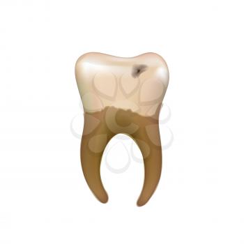 Old sick human tooth with caries on white