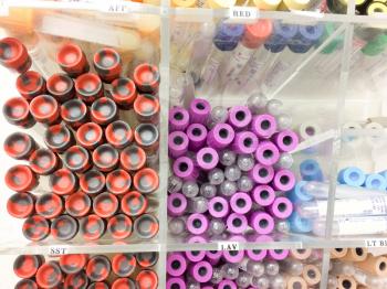 Blood test sample vials at medical laboratory close up